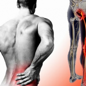 Đầu thần kinh tọa