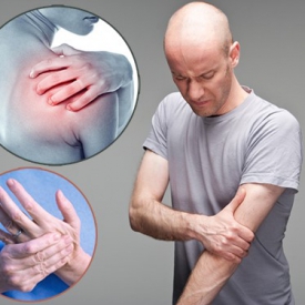 Viêm dây thần kinh cánh tay