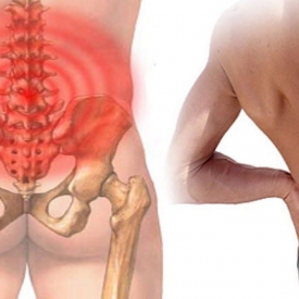 Gai cột sống lưng