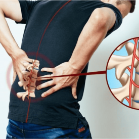 Khỏi đau lưng nhờ vật lý trị liệu viêm cột sống dính khớp