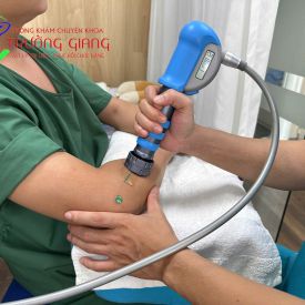 Điều Trị Hội Chứng Tennis Elbow