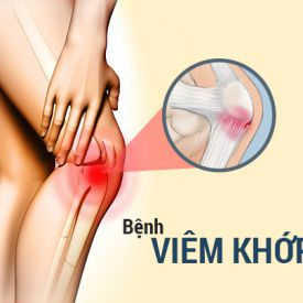 Viêm xương khớp